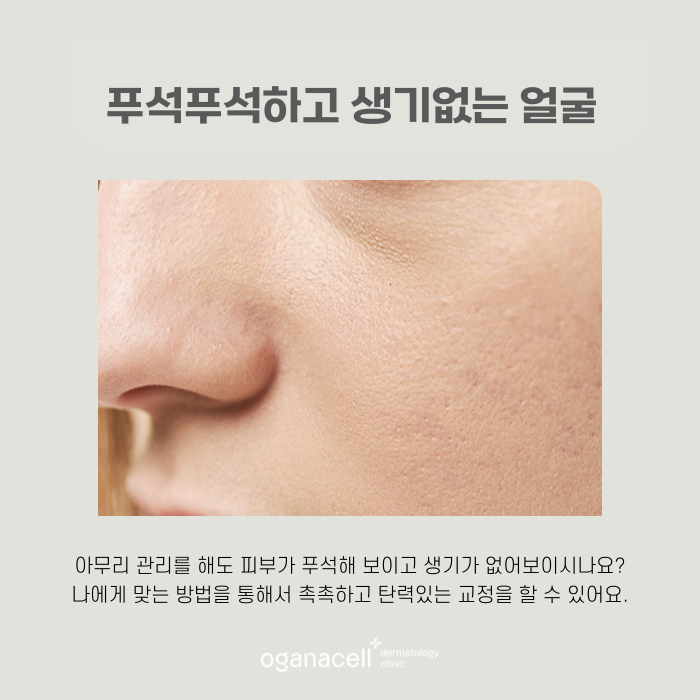 잠실 리쥬란 잘하는 곳 관련 이미지 4