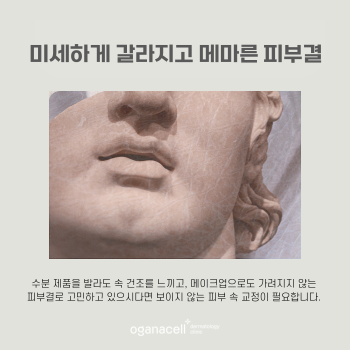 어려지는방법 쥬베룩 효과 관련 이미지 5