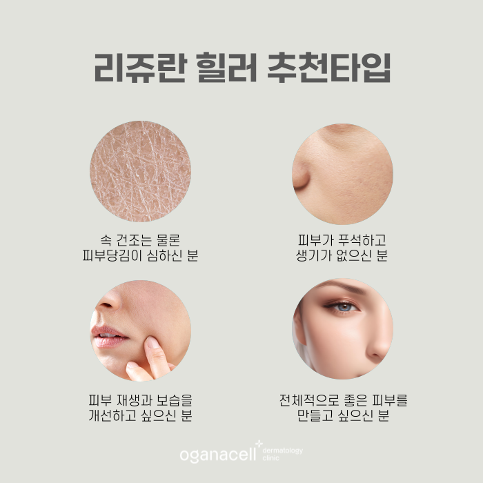 잠실 리쥬란 잘하는 곳 관련 이미지 3