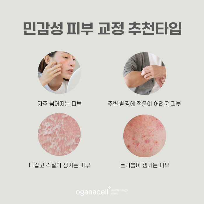민감성피부 좋아지는 법 3가지 관련 이미지 5