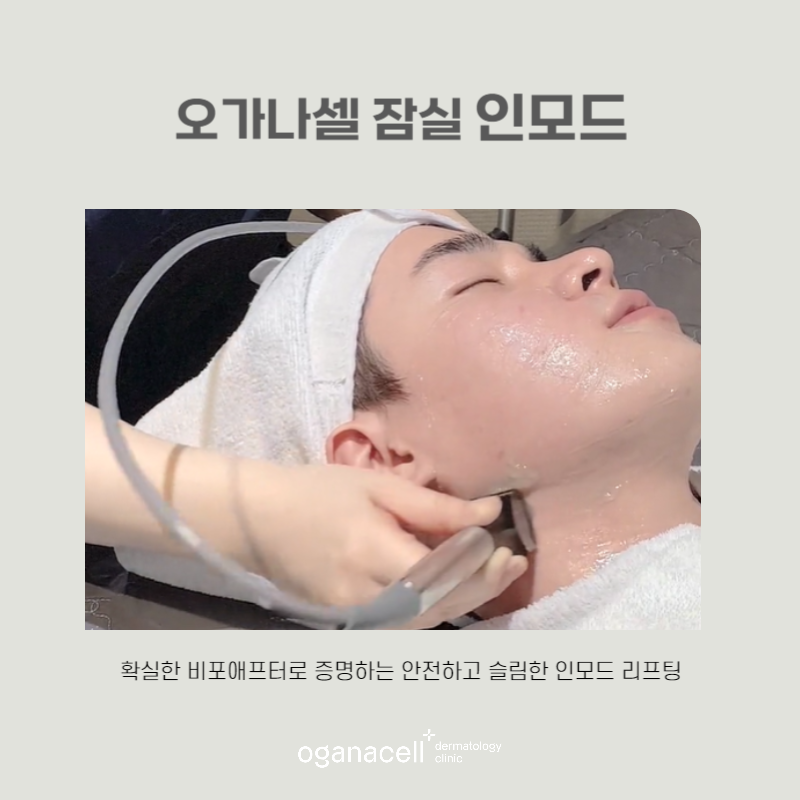 인모드 장점 및 주의할 점 5가지 관련 이미지 6