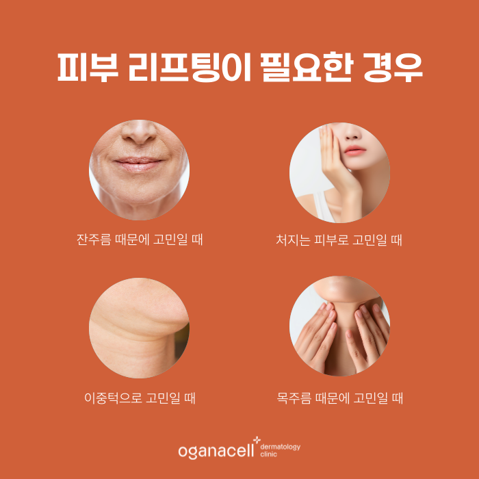 잠실 피부과 임재윤 원장님과 함께하는 리프팅 이벤트 관련 이미지 3