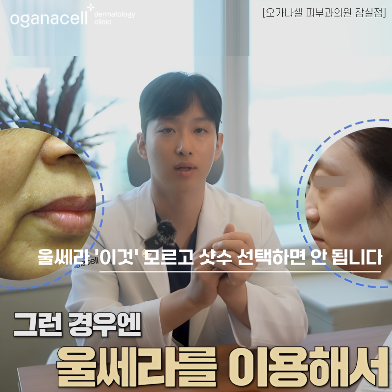 잠실울쎄라 잘하는 곳 관련 이미지 1