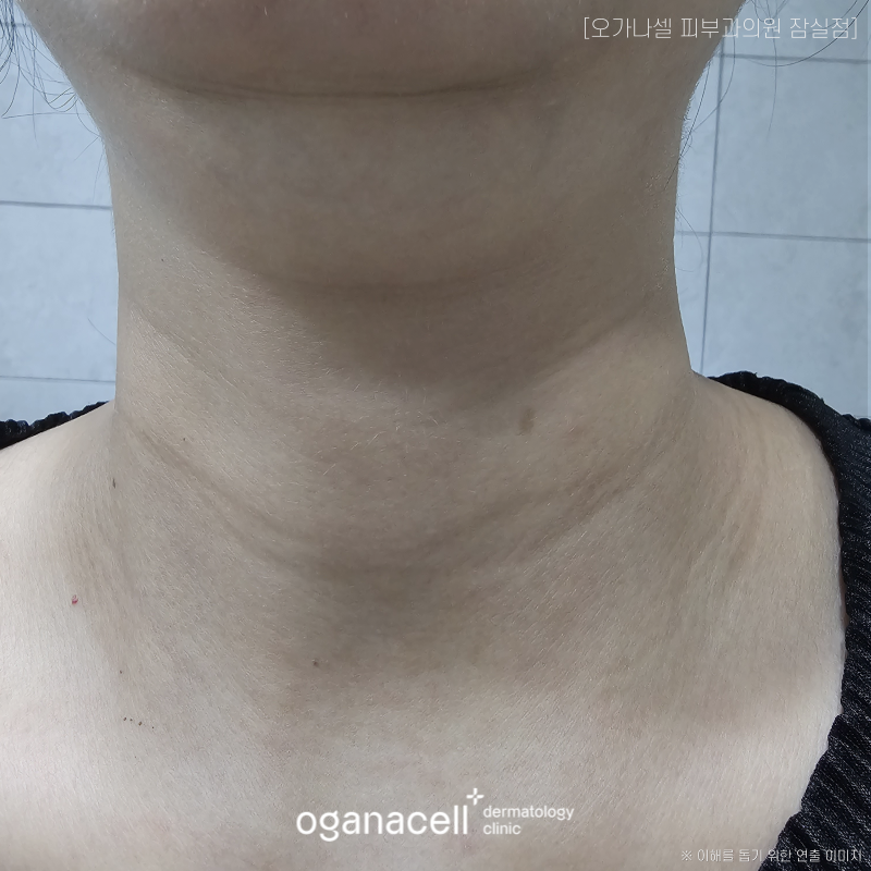 가로 세로 목주름 생기는 원인 등 알아볼게요 관련 이미지 3