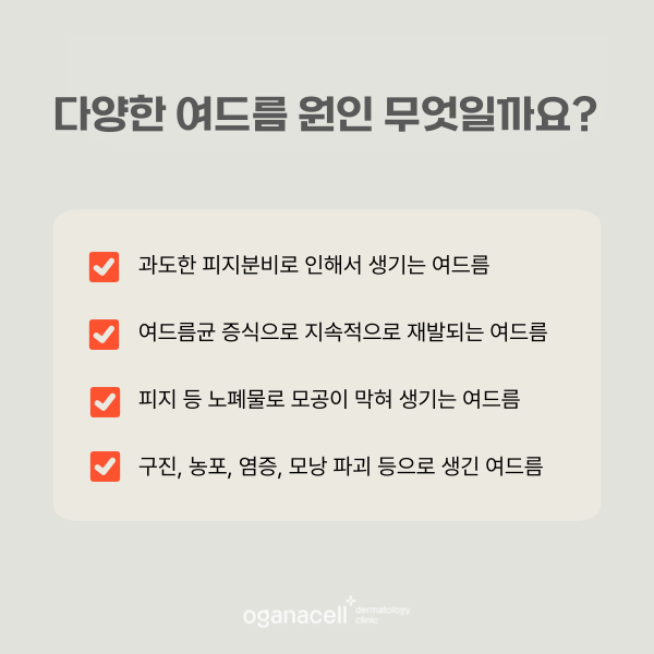 잠실여드름피부과 재발 가능성 낮추는 팁 관련 이미지 6