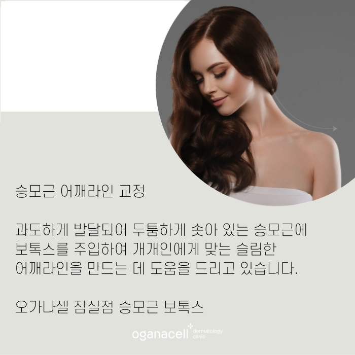 승모근 보톡스 효과 및 유지기간 관련 이미지 9