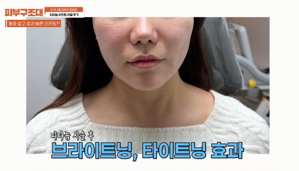 잠실새내 피부과 티타늄리프팅 주의사항 필독! 관련 이미지 11