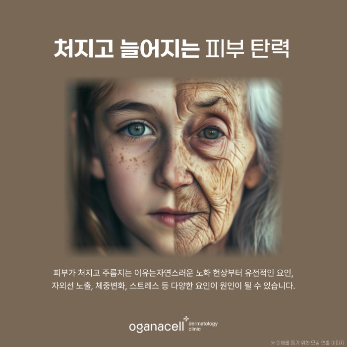 잠실실리프팅 관리주기, 유지기간 등 알아보기 관련 이미지 4