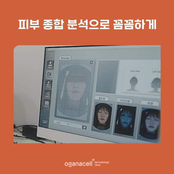 마크뷰피부진단 받을 수 있는 방법 관련 이미지 3