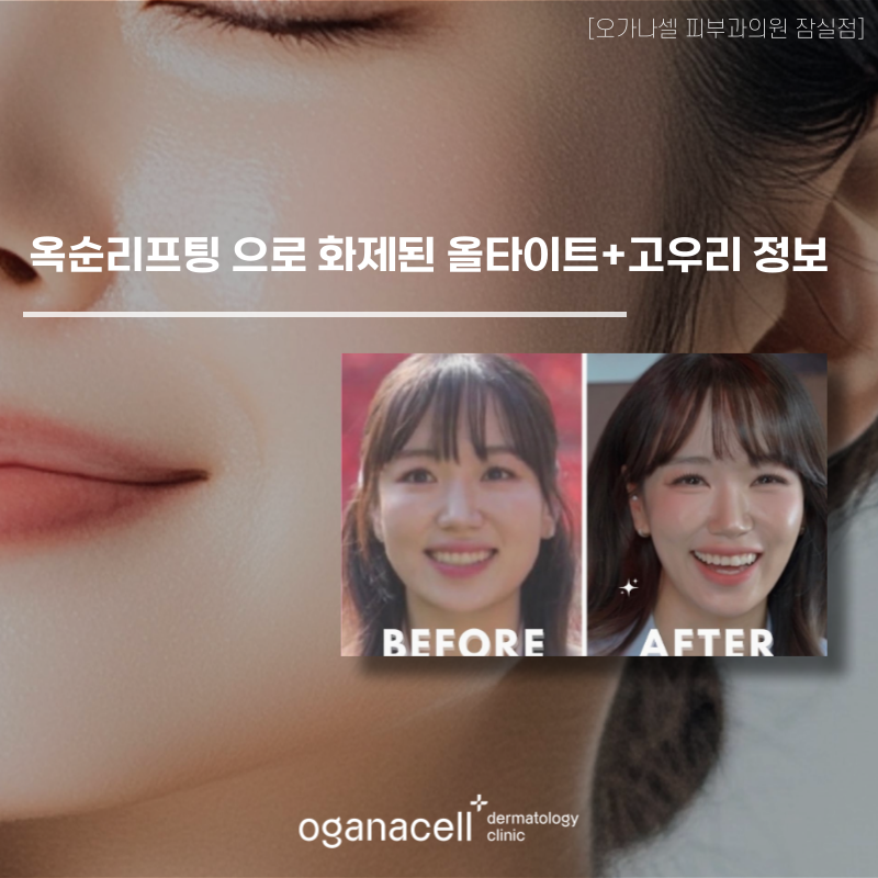 나는솔로 옥순리프팅 으로 화제된 올타이트+고우리 정보 관련 이미지 1