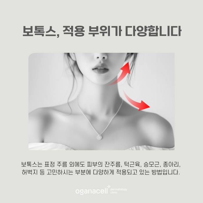 잠실역보톡스 유명한 곳 관련 이미지 5