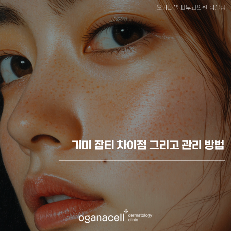 기미 잡티 차이점 그리고 관리 방법 관련 이미지 1