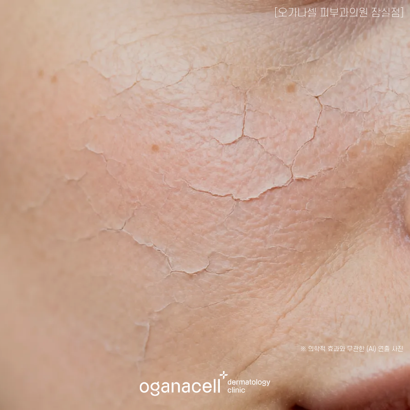 Top 3 Signature Skin Boosters at Jamsil Gowoori image 3