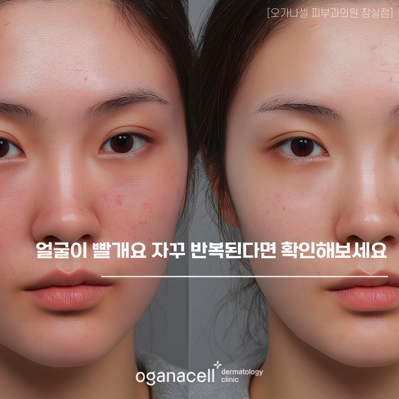 얼굴이 빨개요 자꾸 반복된다면 확인해보세요 관련 이미지 1