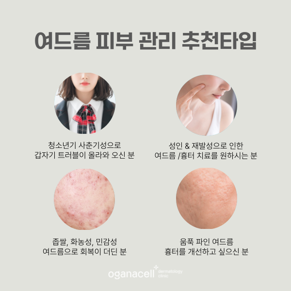 잠실여드름피부과 재발 가능성 낮추는 팁 관련 이미지 3