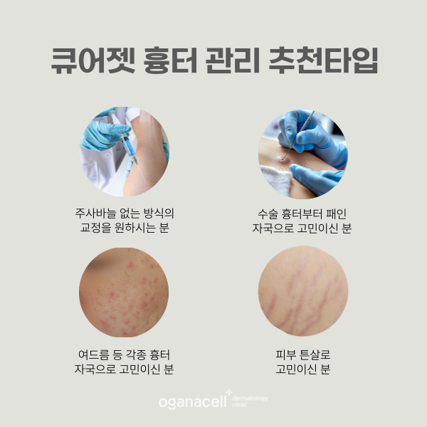흉터 안 아프게 없애는 법 관련 이미지 3