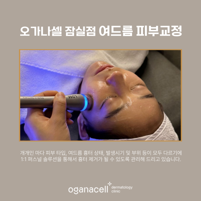 남자여드름피부 잠실피부과 흉터교정 전후 비교 관련 이미지 7