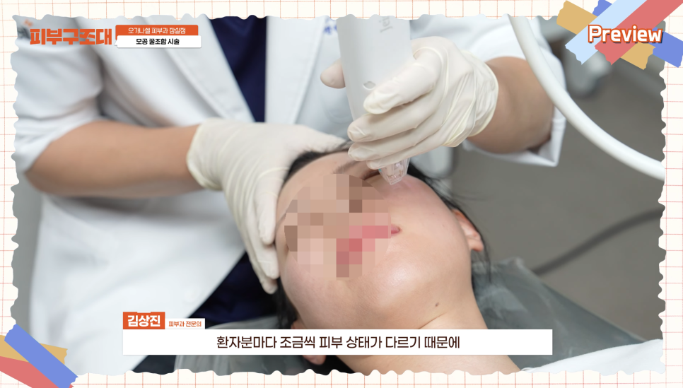 모공 포텐자, 함께 받으면 좋은 잠실피부과 관리 1가지 관련 이미지 15