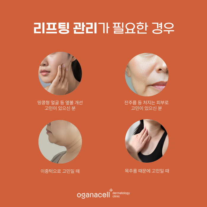 잠실피부과 - 온다, 울쎄라, 써마지, 티타늄 각 특징 알아보기 관련 이미지 3