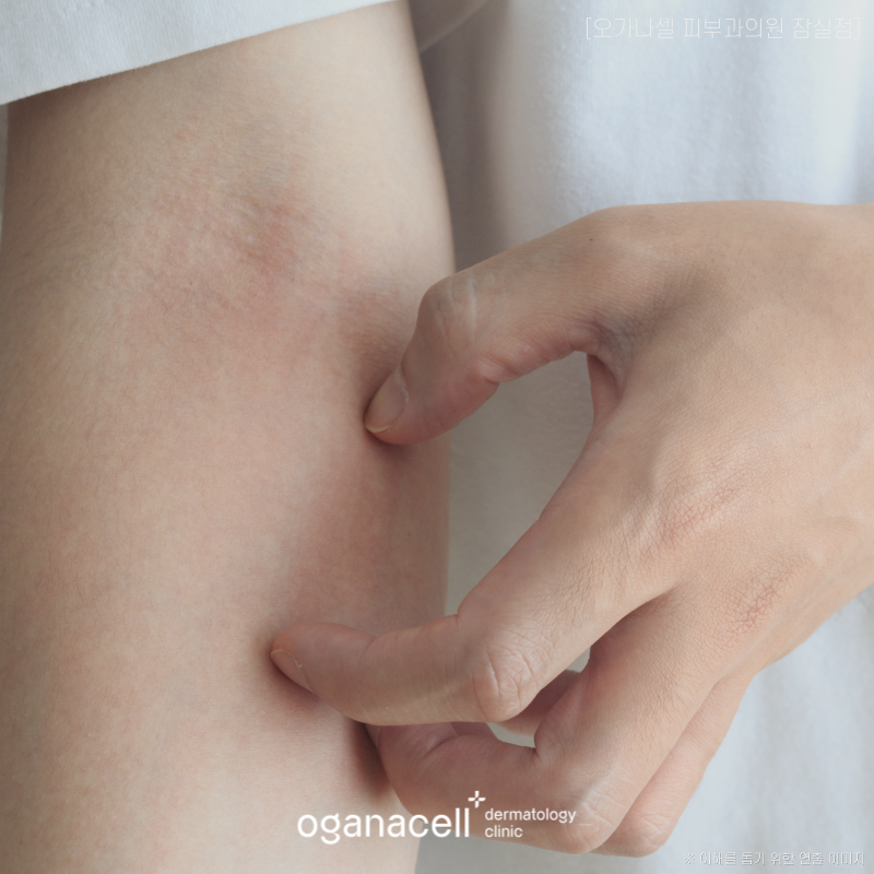 피부 수분 부족 증상 어떤 문제가 있을까? 관련 이미지 3