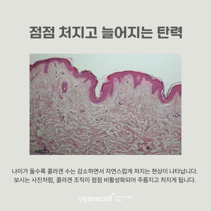 잠실온다리프팅 얼굴, 목, 바디 고민 개선 방법 관련 이미지 5