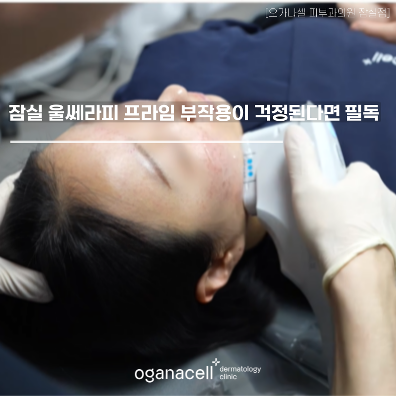 A Must-Read If You’re Concerned About Ultherapy Prime Side Effects in Jamsil image 1