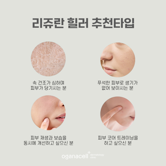 리쥬란 엠보싱 생기는 이유와 맞는 주기 관련 이미지 5
