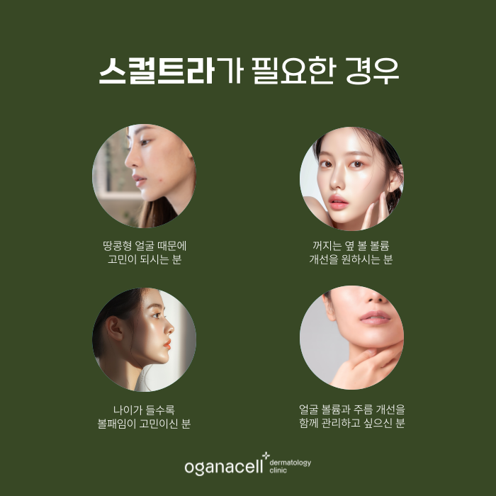 잠실 스컬트라 관리받을 때 주의해야 할 점 관련 이미지 3