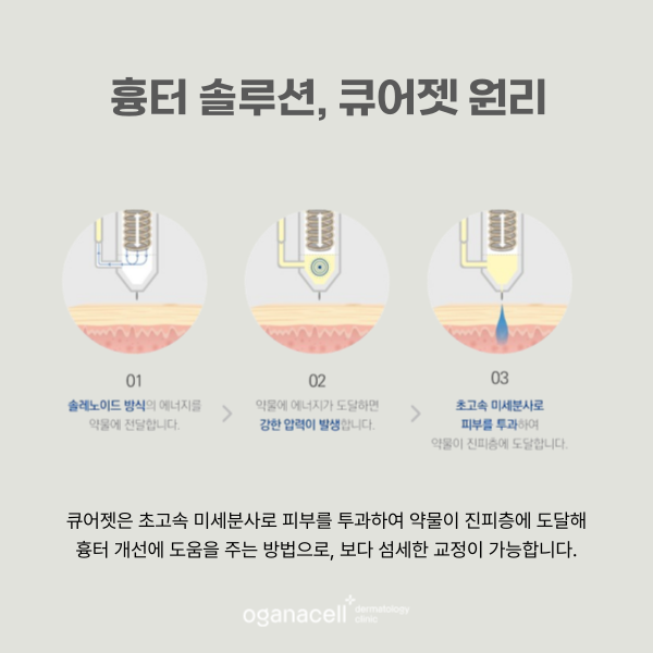 롯데월드타워피부과 흉터 관리 잘하는 곳 관련 이미지 6