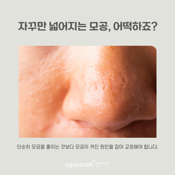 모공 줄이는 법, 커지는 원인부터 알아야 합니다 관련 이미지 6