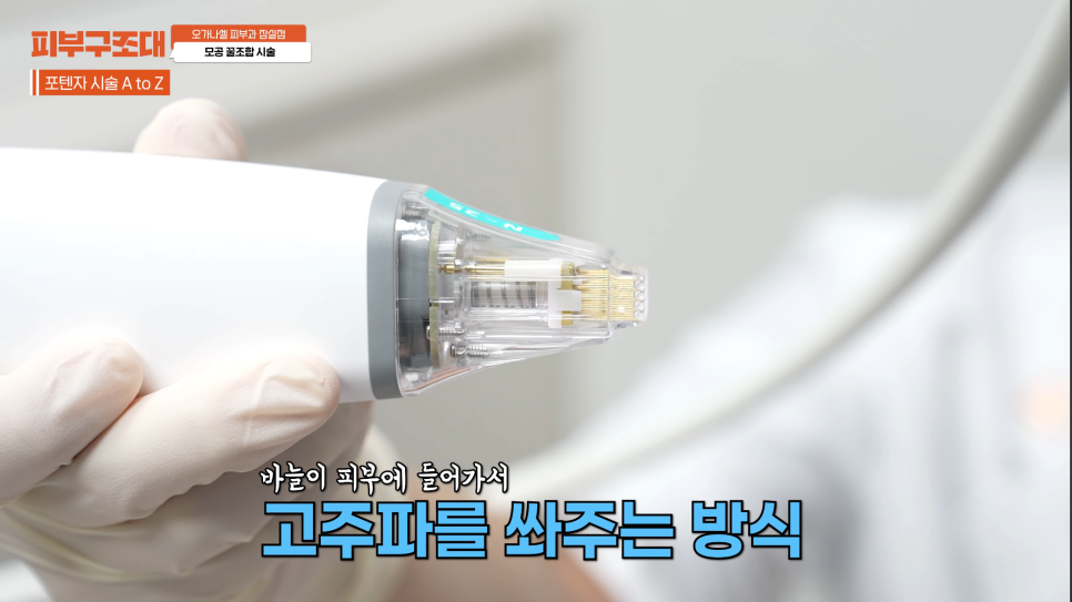 모공 포텐자, 함께 받으면 좋은 잠실피부과 관리 1가지 관련 이미지 6