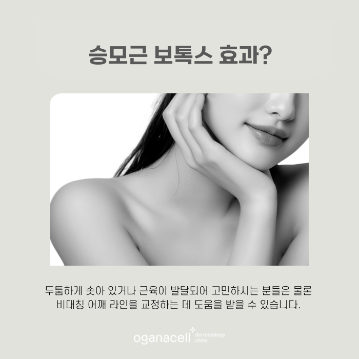 승모근 보톡스 효과 및 유지기간 관련 이미지 5