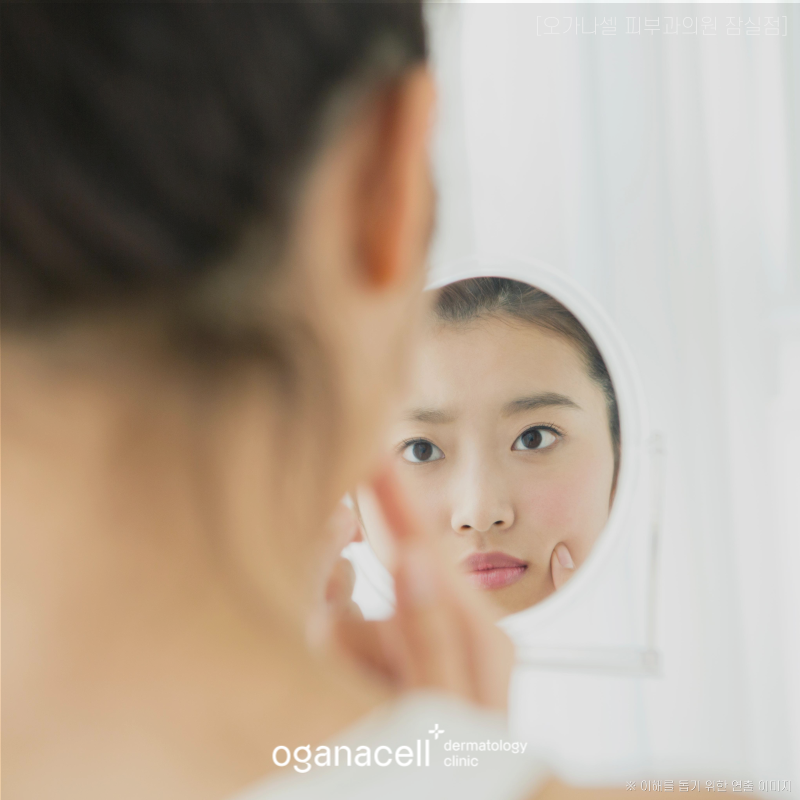 How to Care for Acne Scars, Step by Step Without Irritation image 5