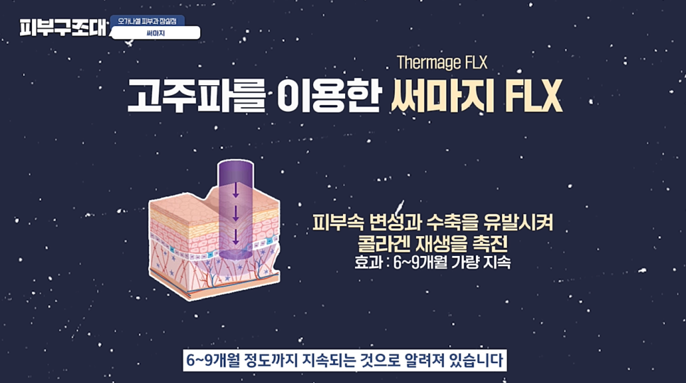 써마지 고민될 때 부위 비용 샷수 등 꼭 알아야 할 꿀팁 영상 관련 이미지 4
