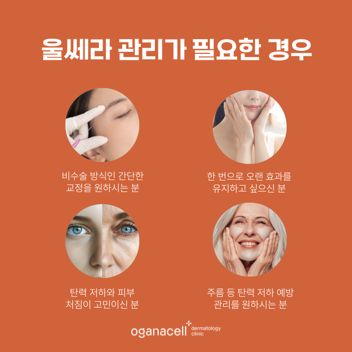잠실 울쎄라 400샷 하면 좋은점 관련 이미지 3
