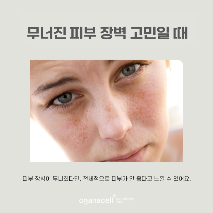 리쥬란 엠보싱 생기는 이유와 맞는 주기 관련 이미지 6