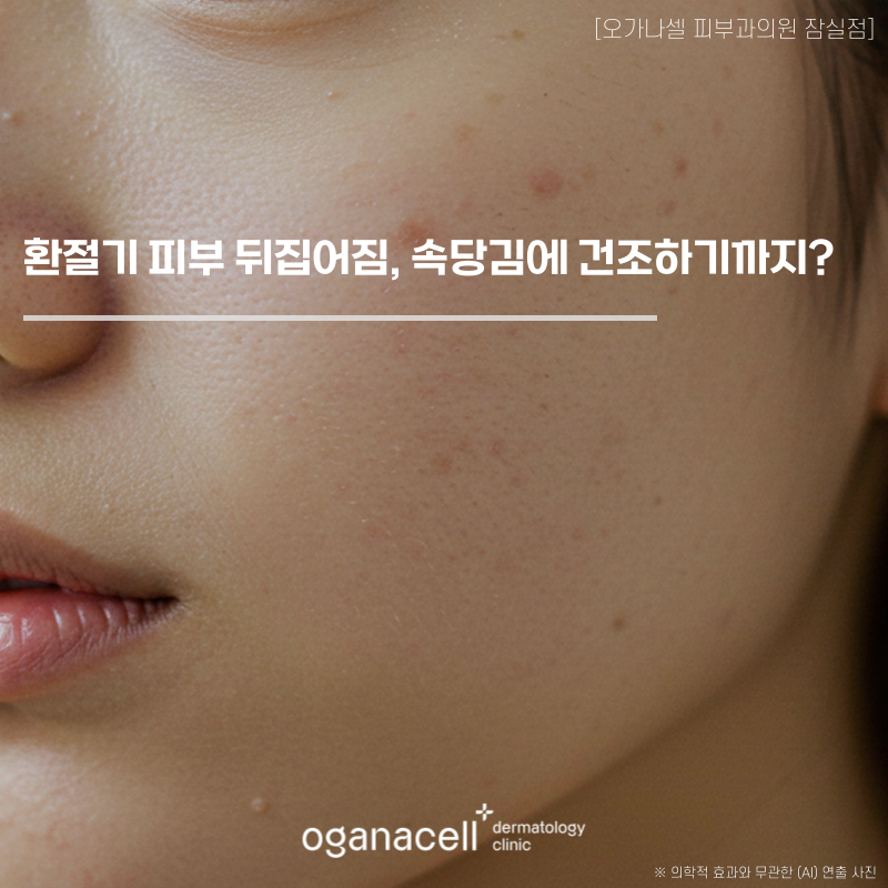 환절기 피부 뒤집어짐, 벌써 속당김에 건조하다면? 관련 이미지 1