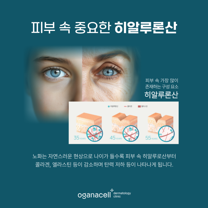 겨울철피부관리 1회 관리로 6개월 지속해주는 스킨바이브 관련 이미지 5