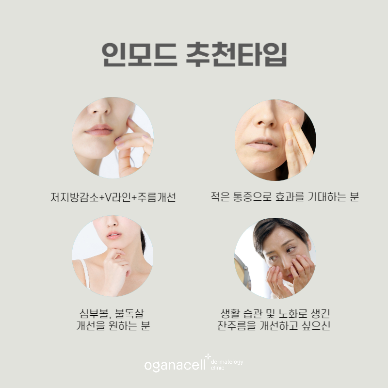 인모드 장점 및 주의할 점 5가지 관련 이미지 3