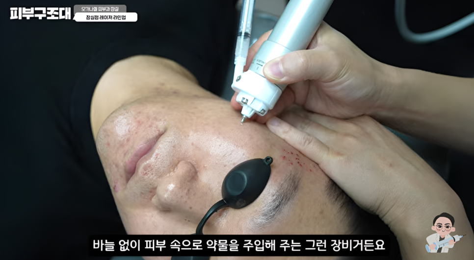 잠실피부과 오가나셀 프리미엄 장비 소개 관련 이미지 6