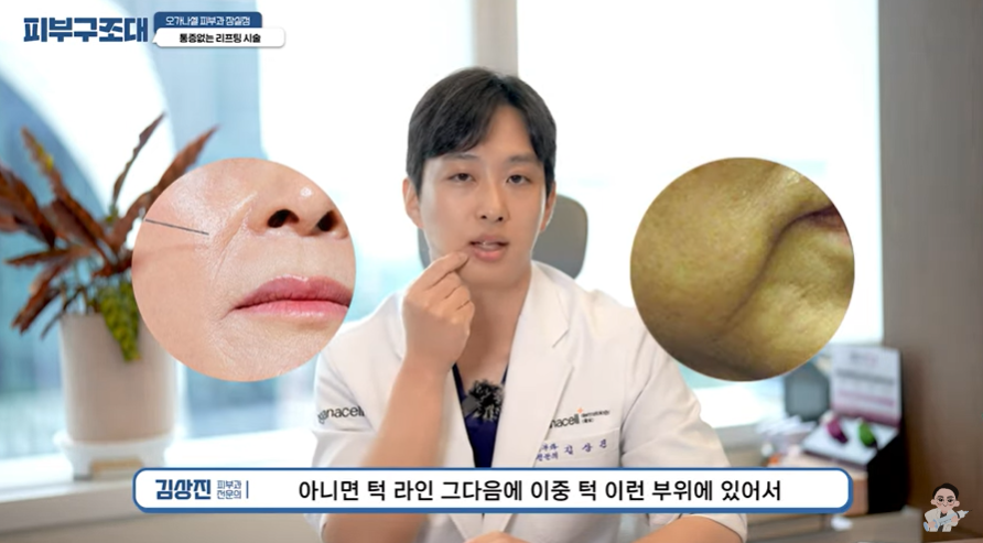 잠실 피부과전문의도 셀프로 하는 온다리프팅 관련 이미지 5