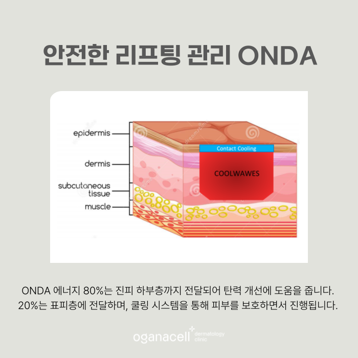 목주름 관리 방법 새로운 기술ONDA 관련 이미지 5