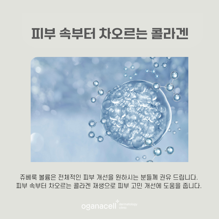 잠실쥬베룩볼륨 잘하는 곳 관련 이미지 5