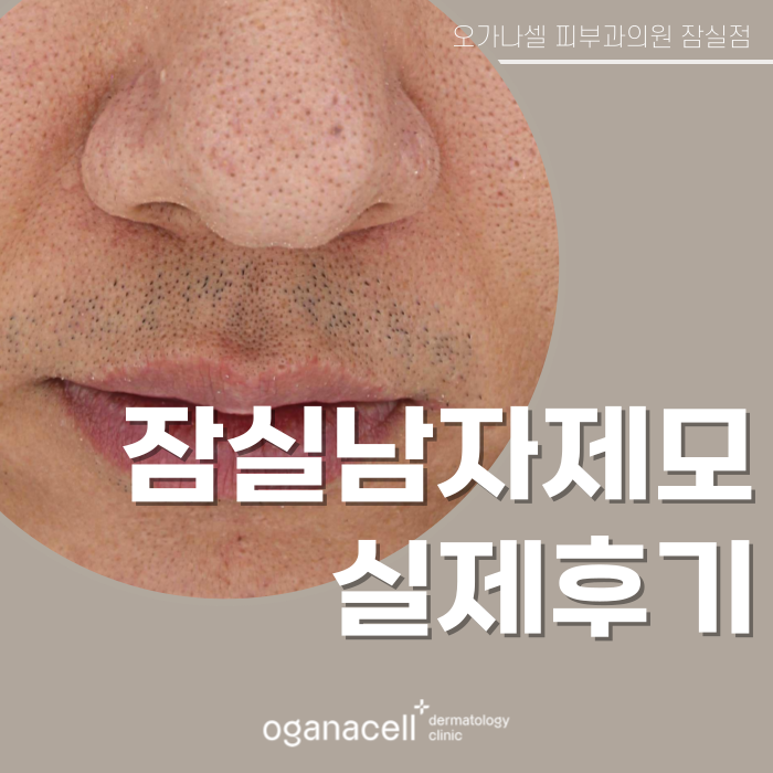 잠실남자제모 전후 비교 후기 관련 이미지 1