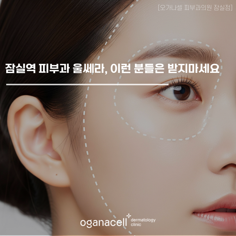 잠실역 피부과 울쎄라 정보, 이런 분들은 받지 마세요 관련 이미지 1