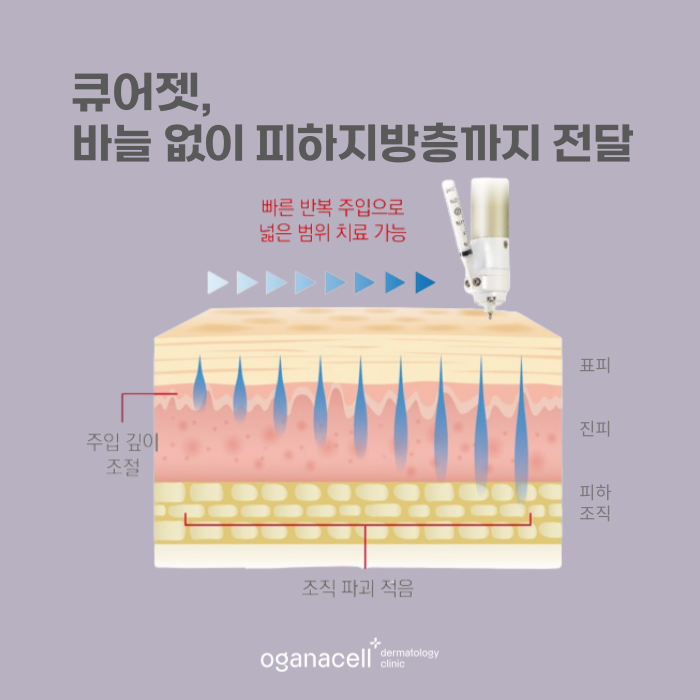 잠실 큐어젯 있는 피부과 관련 이미지 7