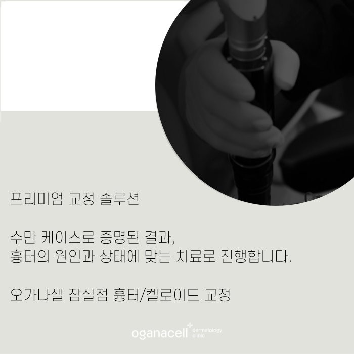 튀어나온 흉터 켈로이드 특징과 치료 시기 관련 이미지 11
