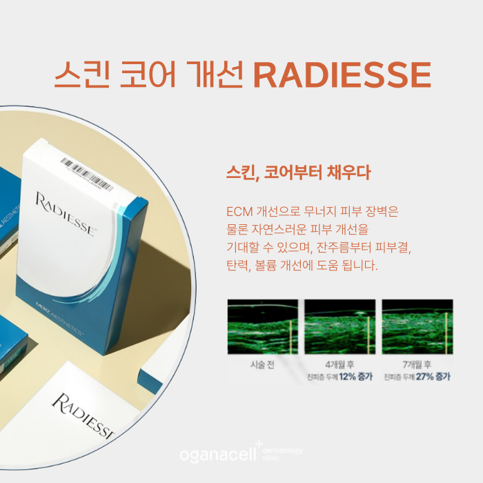 잠실콜라겐주사 레디어스 특별한 이유 관련 이미지 6