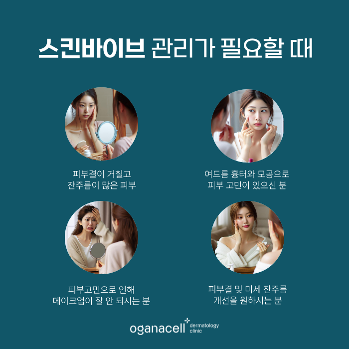 겨울철피부관리 1회 관리로 6개월 지속해주는 스킨바이브 관련 이미지 3