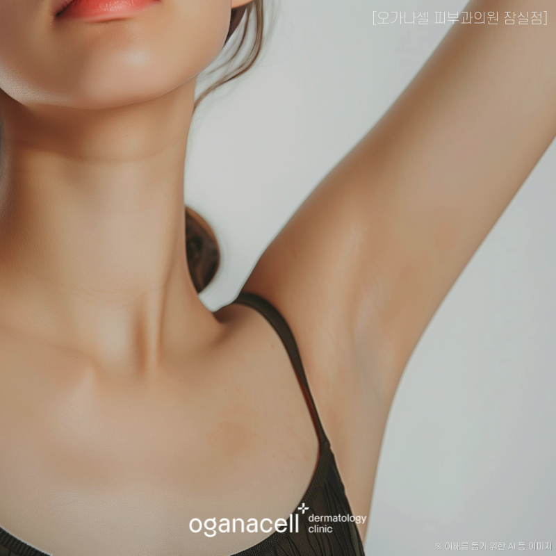 잠실 여의사 피부과전문의 가 알려드리는 겨드랑이제모 주의사항 관련 이미지 5